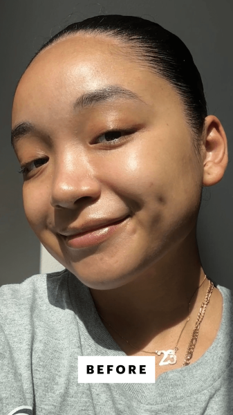 Richards before applying the Nars Soft Matte Concealer